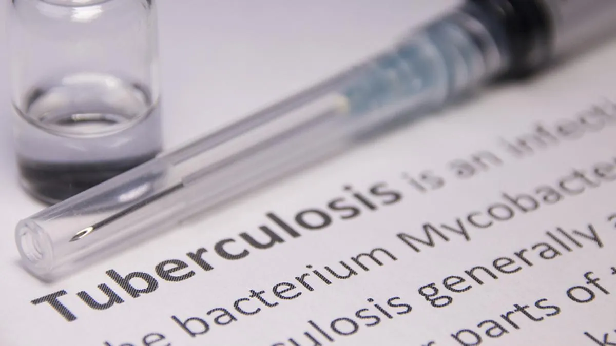 TB survivors seek government clarification on continuity of medicines and diagnostic supplies&nbsp;amid global conflict